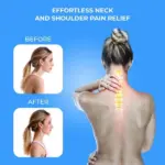 Neck Stretcher