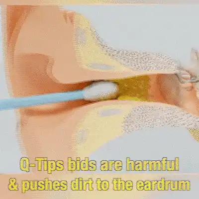 Comparison of cleaning your ears with cotton swabs.